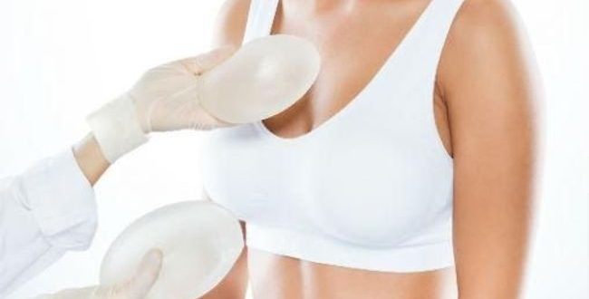 Prothèses mammaires : en liquide physiologique ou MENTOR ?