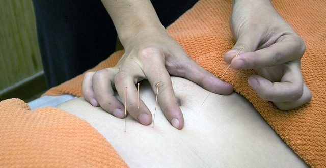 Acupuncture : soulagez les troubles digestifs sans médicaments grâce à cette méthode naturelle