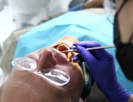Les implants dentaires en complément des prothèses : une révolution en denturologie